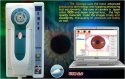 IRISCOPIO (TOSHIBA CCD)