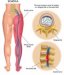 ACUPRESIN ESPECFICA PARA CITICA